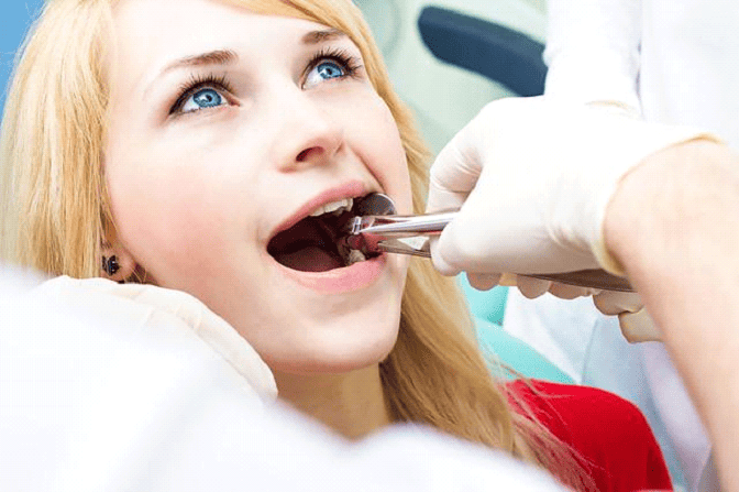 Tooth Extraction Healing - A-Dental Center